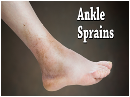 anklesprain